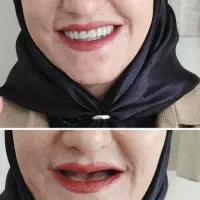 دندانسازی خلخال اقساطی