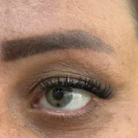 کاشت مژه هیدن