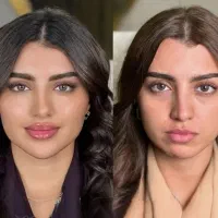 فول فیس عربی و اروپایی بوتاکس