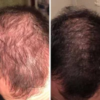 فقط نیازه اقدام کنی