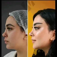 ژل لب بوتاکس لیزر فیلر هایفو لاغری تغذیه بلفارو