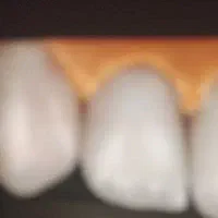 دستیار دندانپزشک