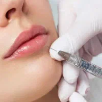 افتتاحیه کلینیک زیبایی رو باتخفیف ویژه فیلر و....