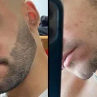 این سرم بیش از حد ممنوع هست