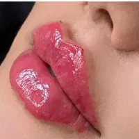 خدمات بوتاکس ژل و‌فیلر