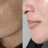 روشن کننده پوست