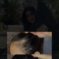 کاشت و مروتراپی نکن بیا سرم بزن