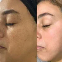 تویی که از لک هات خسته شدی از این اگهی رد نشو