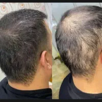 کمکت از افسردگی در بیار