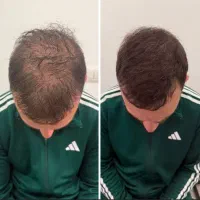 این اقدام اخریشه