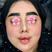 خدمات تزریق ژل و بوتاکس فیلر