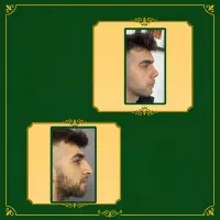 صورت مردونه از اینجا شروع میشه