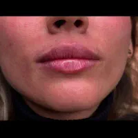 تخفیف ویژه جهت تکمیل آلبوم کاری