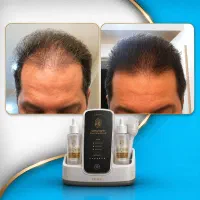 معجزه قرن