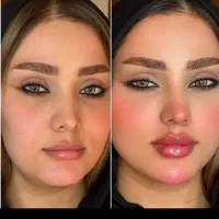 نخ کل صورت الان 5900 ولی از دوشنبه میشه 4500