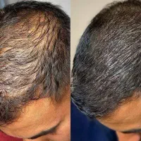 این نتیجه واقعی رو ببین