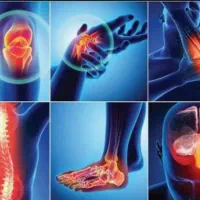 شکسته بندی کریمی