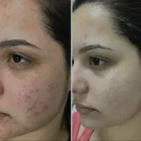 پخش عمدوتک کرم معجزه سوپر آلفا اصل و اورجینال