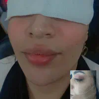 خدمات تزریق ژل اف 500 بوتاکس و لیفت با نخ امیری