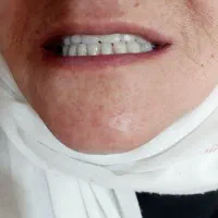 دندان masnoee