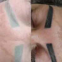 تخفیف ویژه آرایش دائم