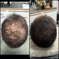 سرم تقویت‌کننده و ضد ریزش مو