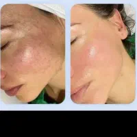 با تکنیک پوست بچه پوستت رو مثل بچه کن