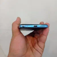 Xiaomi Redmi not 11|موبایل|آزادشهر, |دیوار