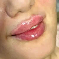 خدمات ژل و بوتاکس و پاکسازی پوست