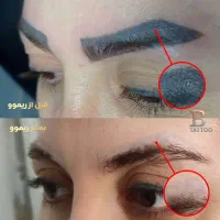 پاک کردن تتوابرو،خطچشم،خطلب(ریموو)