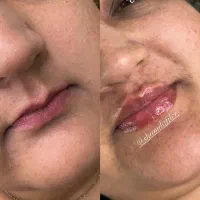 نیاز به مدل فیلر برای تکمیل البوم کاری