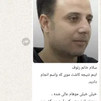 کاشت مو تضمینی