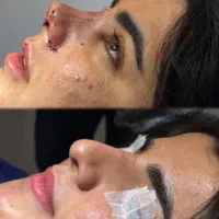 آف محدودجشنواره عمل بینی دراهواز۲۵تومن
