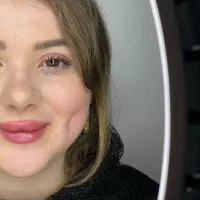 پیرسینگ/ چالگونه/میکرودرمال