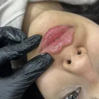 کلینیک تزریق ژل بوتاکس لیزرmd cods لاغری هایفوپزشک