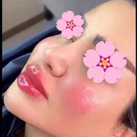 تزریق ژل وبوتاکس،آموزش،پک،مادلینگ۵۰٪تخفیف