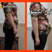 بمب چربی سوزی و بدون رژیم سخت