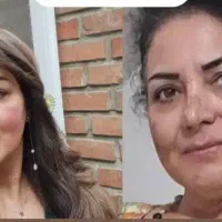 لیزر موهای زائد بانوان با دستگاه تیتانیوم آلما