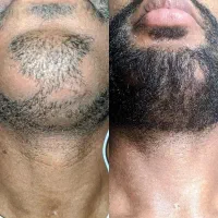 دیگت اعصابتو برای ریشت خورد نکن