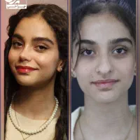 عمل بینی گوشتی/ اقساط بدون سود و بهره