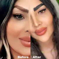 مدل کاشت ابرو