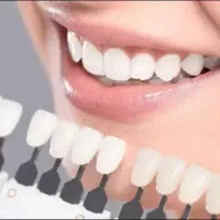 دکتر اصلاحی. دندان مصنوعی کامل 25میلیون اقساطی