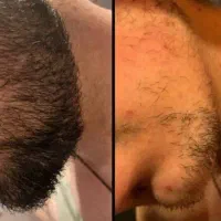 ریشت رو خاص تر کن