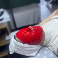 پاکسازی و فیشال درمانی پوست|خدمات آرایشگری و زیبایی|تهران, نظام‌آباد|دیوار