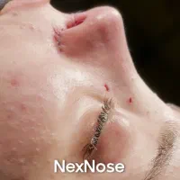 جراحی بینی ۳۵تومن با شرایط اقساط متخصص فک و صورت