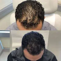 جاهای خالی را پر کنید محصول رویش مو صددرصد گیاهی