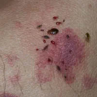 سمپاشی تضمینی ساس سوسک موش کنه و..سم پاشی کل حشرات