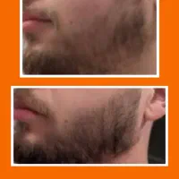 تقویت کننده مو ریش موخوره کراتینه