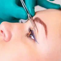 تزریق چربی و لابیاپلاستی