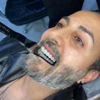 بیا ساری فک بالاتو کامپوزیت کن فک پایین رایگان بزن
